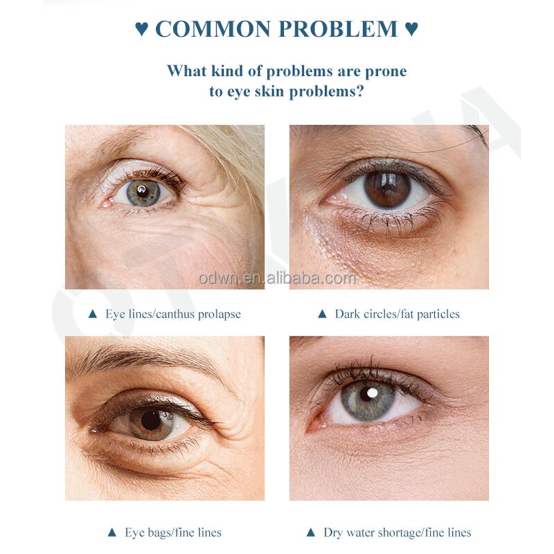 Anti Wrinkle Cream Manufacturer - Private Label Instant Removal Treatment