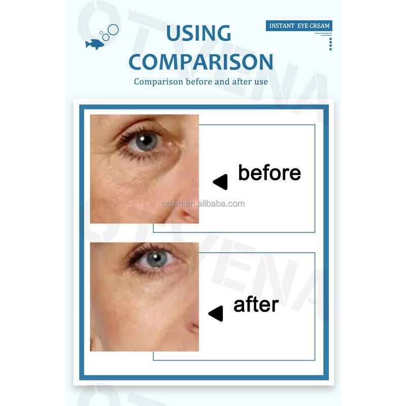 Eye Cream Manufacturer - Custom Dark Circle & Fine Lines Removal 8ml