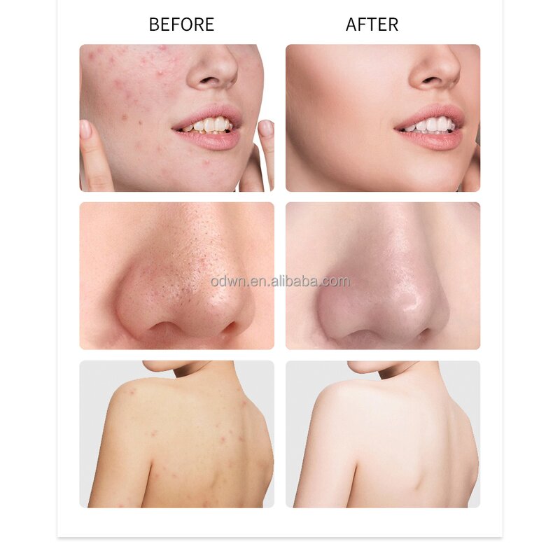 Goat Milk Soap Manufacturer - Wholesale Organic Anti Acne Whitening Soap