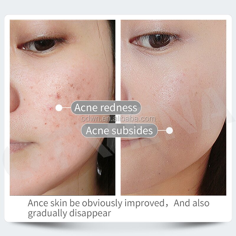 Lanolin Soap Manufacturer - Wholesale Whitening & Brightening Soap