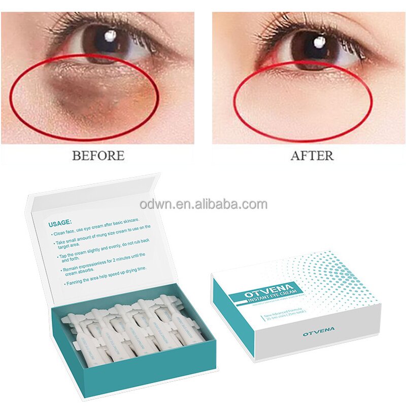 Eye Cream Manufacturer - Custom Anti Wrinkle & Puffiness Treatment