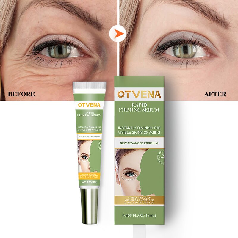 Eye Cream Manufacturer - For Puffy Dark Circles Under Eyes