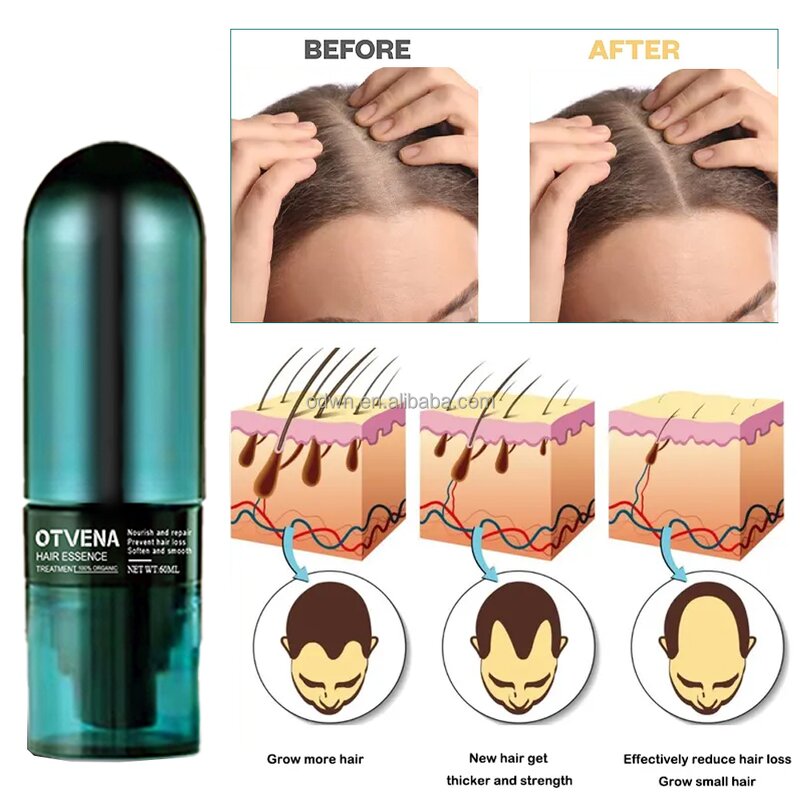 Hair Serum Spray Manufacturer - OEM High Quality Anti Hair Loss