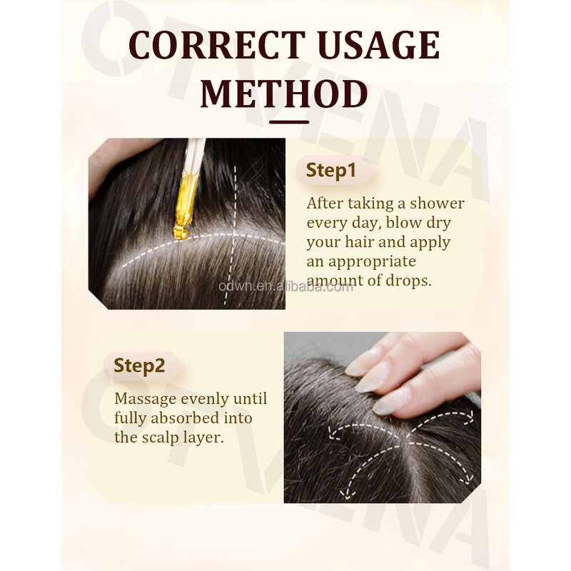 Hair Care Oil Manufacturer - Famous Fast Growth Anti Hair Loss 20ml