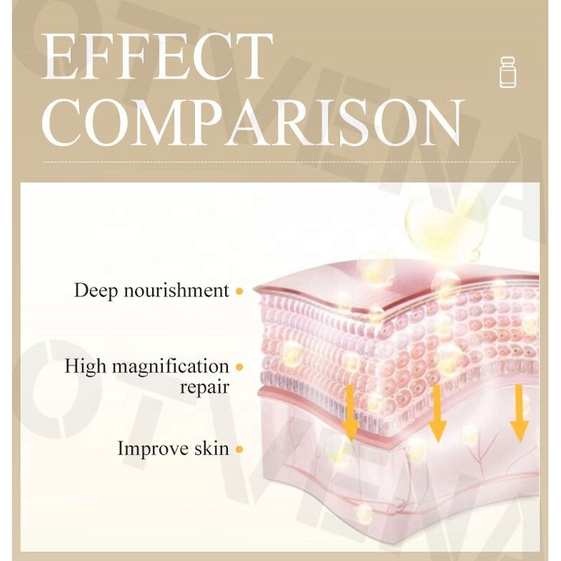 Face Serum Manufacturer - OEM Anti Melasma Acne Removal Lyophilized Powder