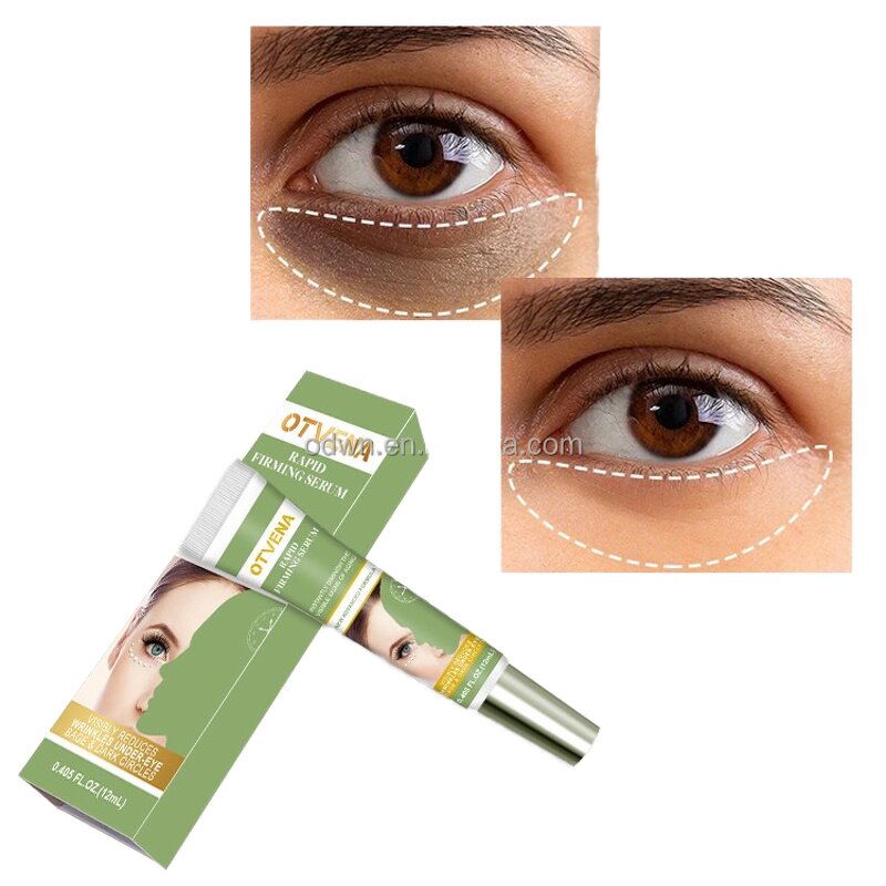 Eye Cream Manufacturer - Low Price Anti Wrinkle Gel Dark Circle Removal