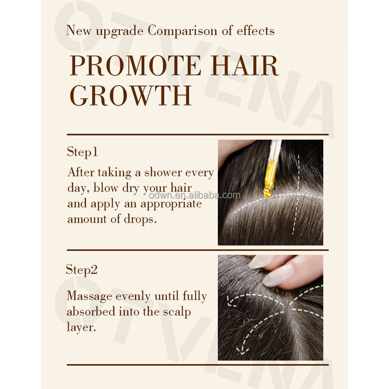 Hair Care Oil Manufacturer - OEM Famous Fast Growth Anti Hair Loss 20ml