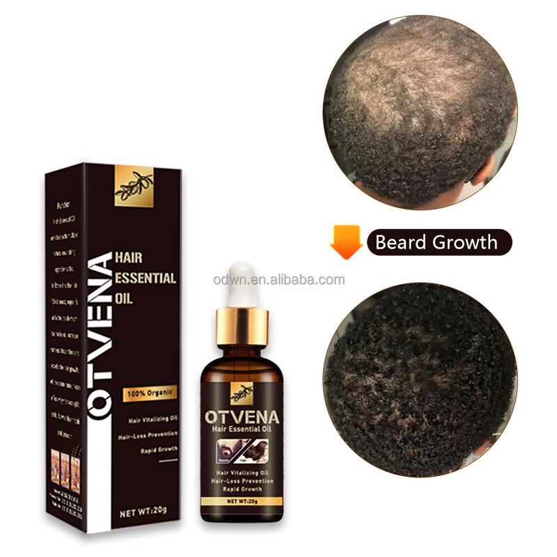 Hair Growth Oil Manufacturer - OEM Organic Fast Hair Loss Treatment
