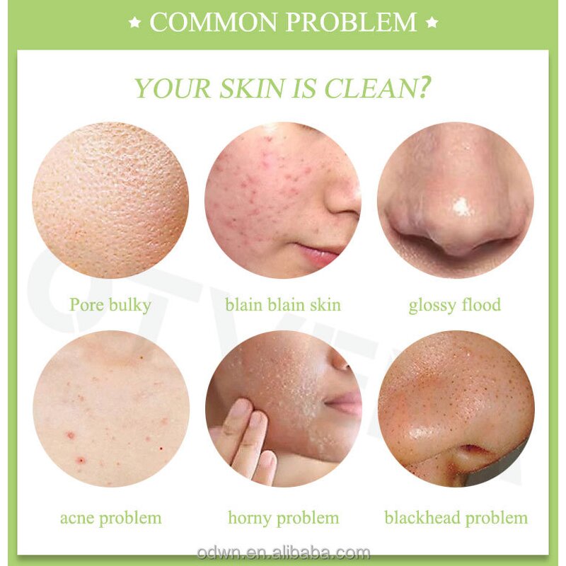 Whitening Soap Manufacturer - Goat Milk Melt and Pour Soap Base