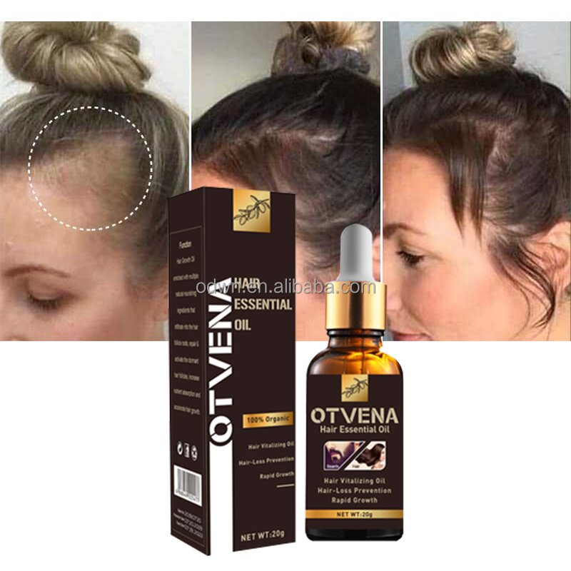 Hair Growth Oil Manufacturer - Private Label Organic Promote Growth