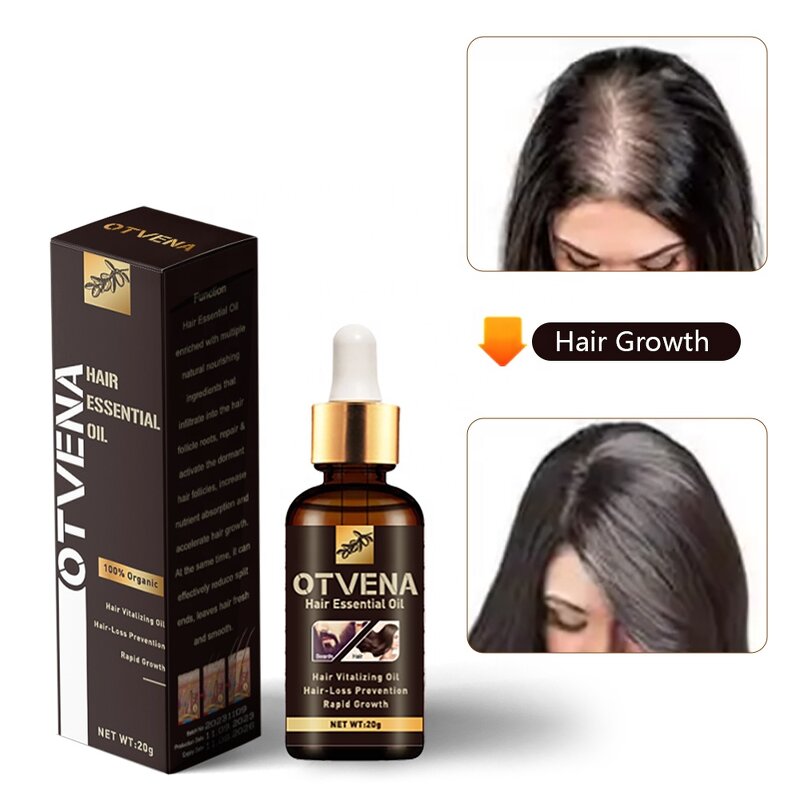 Hair Growth Oil Manufacturer - Nourishing Treatment Prevents Breakage