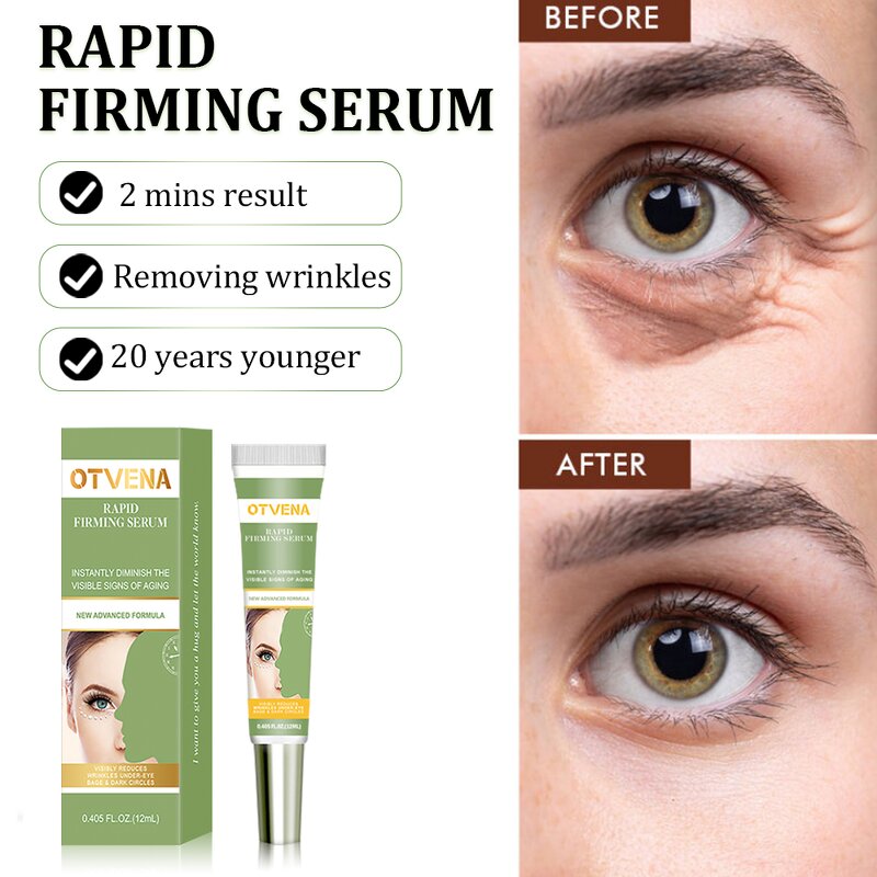 Eye Cream Manufacturer - For Puffy Dark Circles Under Eyes