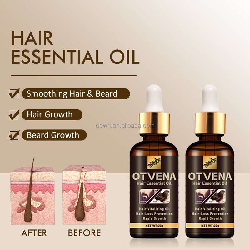 Hair Care Oil Manufacturer - OEM Famous Fast Growth Anti Hair Loss 20ml