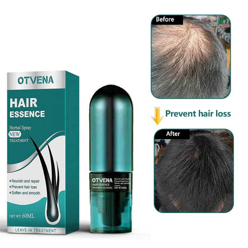 Hair Essence Manufacturer - Fast Repair & Nourish Prevents Hair Loss