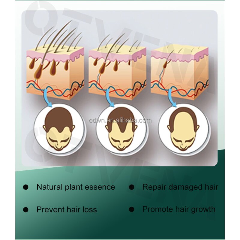 Hair Spray Manufacturer - Custom Instant Volume Root Lift Essence