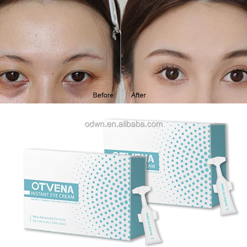 Eye Cream Manufacturer - Custom Instant Wrinkle & Eye Bag Removal