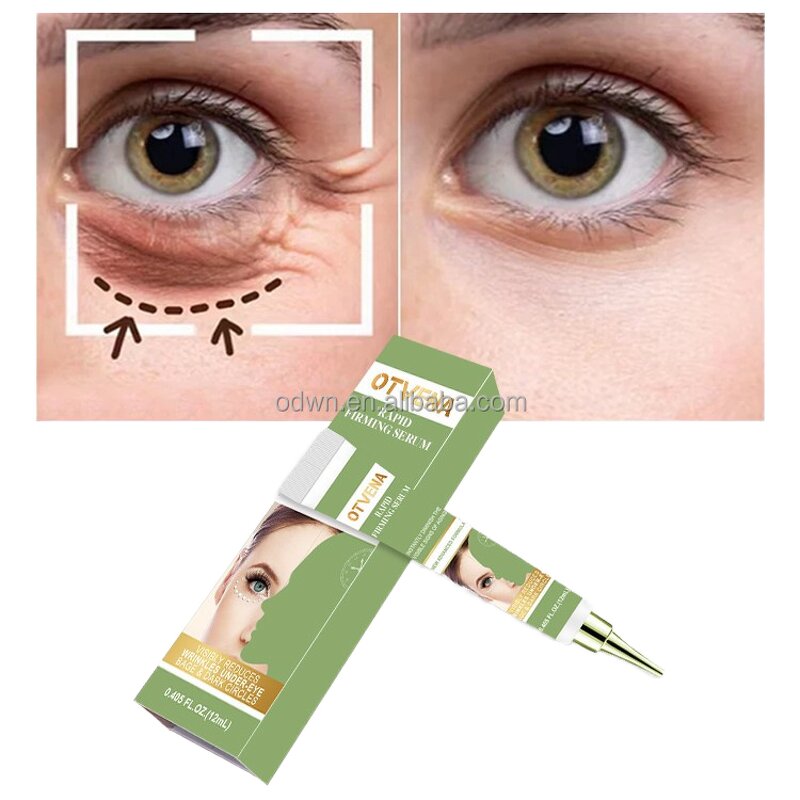 Eye Cream Manufacturer - Low Price Anti Wrinkle Gel Dark Circle Removal