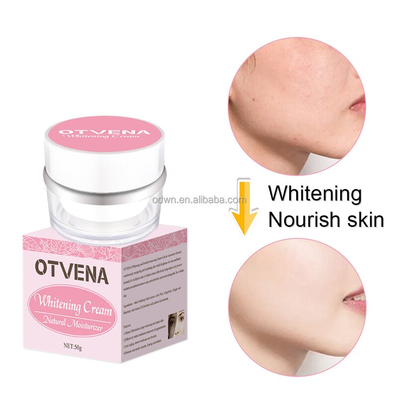 Whitening Cream Manufacturer - OEM Factory Miracle Freckle Removal