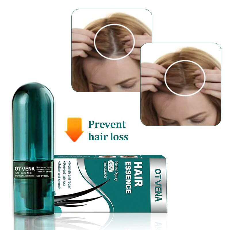 Hair Essence Manufacturer - Fast Repair & Nourish Prevents Hair Loss