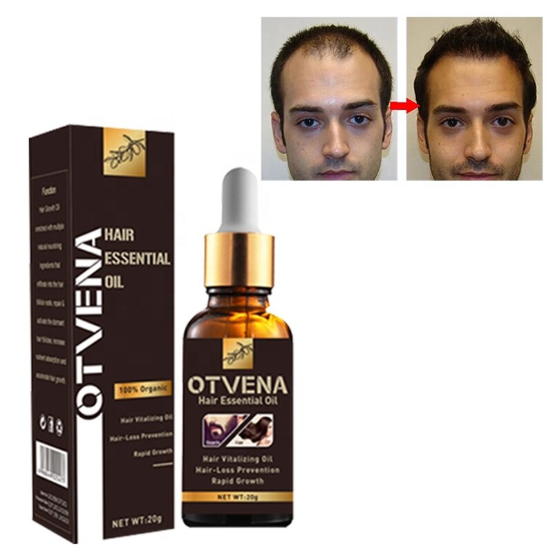 Hair Growth Oil Manufacturer - OEM Natural Moisturizing Anti Hair Loss