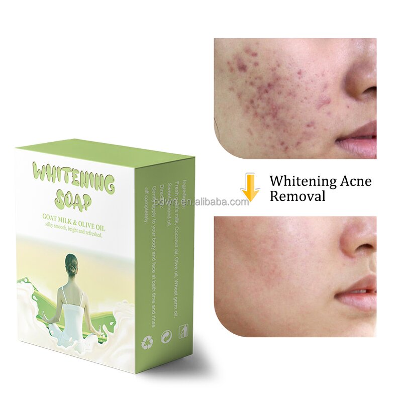 Goat Milk Soap Manufacturer - Thai Moisturizing Whitening Acne Body Soap