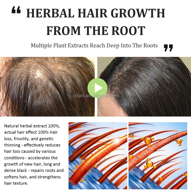 Hair Spray Manufacturer - Custom Instant Volume Root Lift Essence