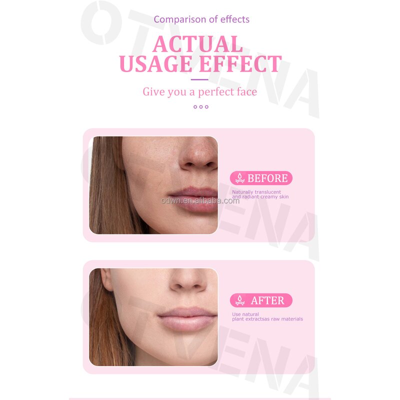 Whitening Cream Manufacturer - OEM Factory Miracle Freckle Removal