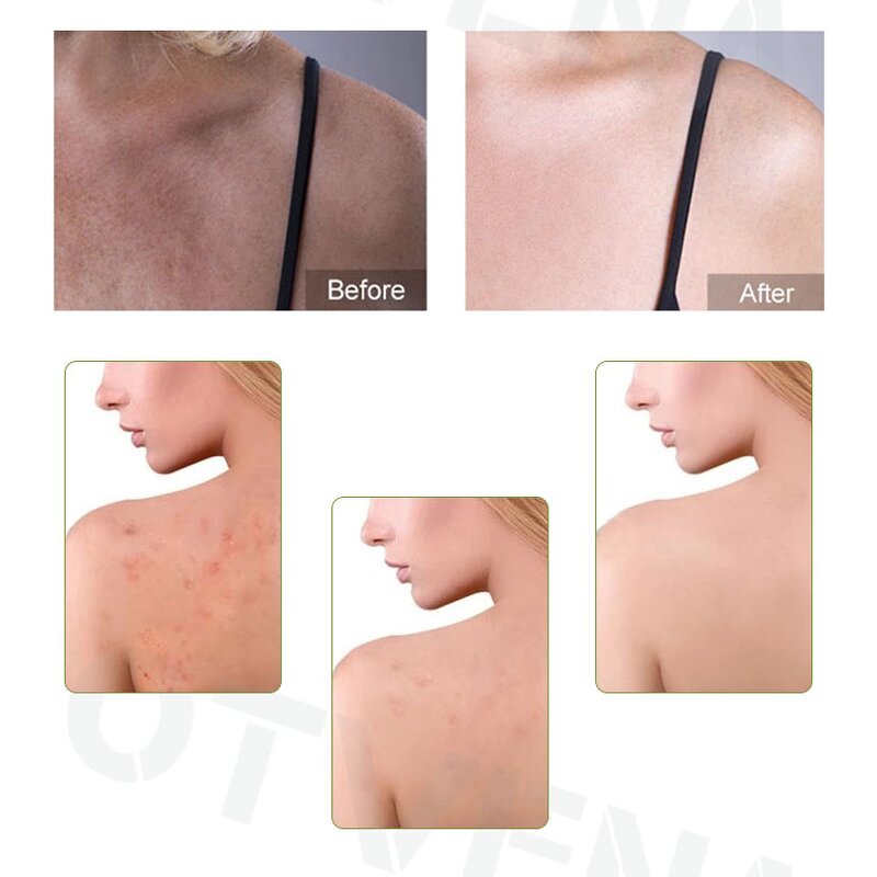 Whitening Soap Manufacturer - Natural Formula Skin Care Soap