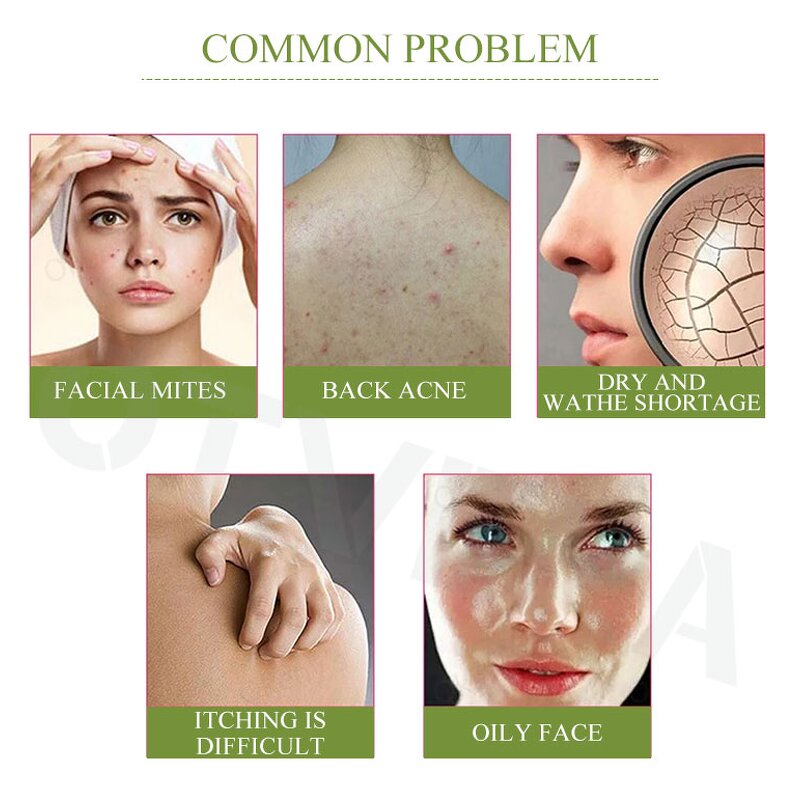 Whitening Soap Manufacturer - Natural Formula Skin Care Soap