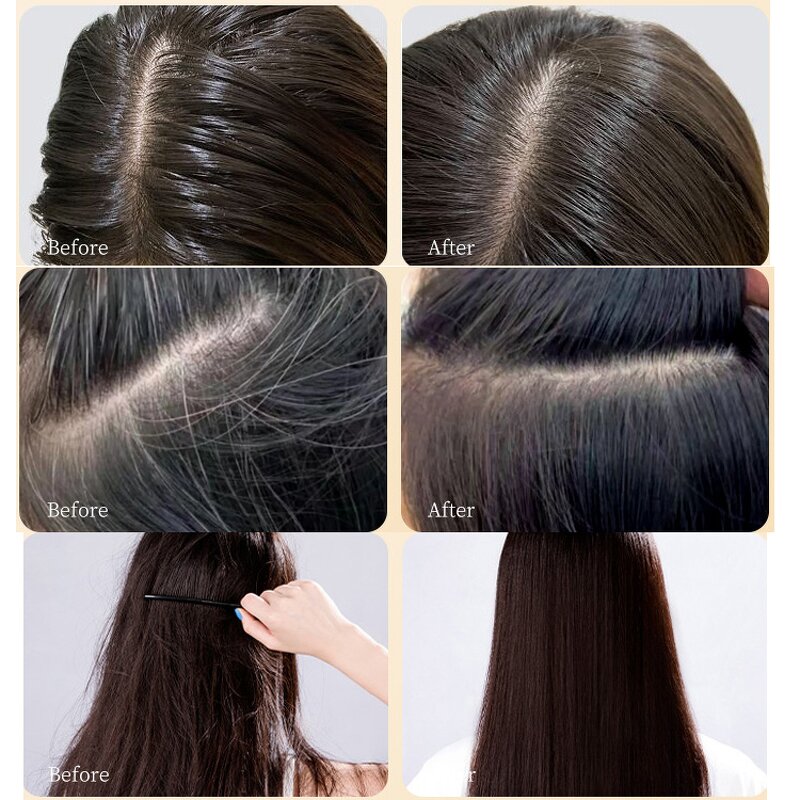 Hair Growth Spray Factory - OEM Polygonum Multiflorum Anti-hair Loss