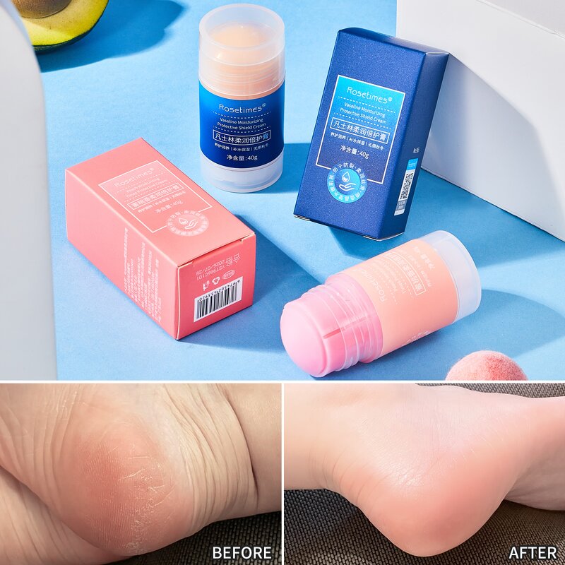 Heel Balm Factory - OEM Rosetimes Natural Moisturizing Foot