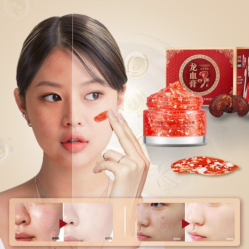 Anti-Wrinkle Cream Supplier - OEM Hot Selling Light Line Brightening