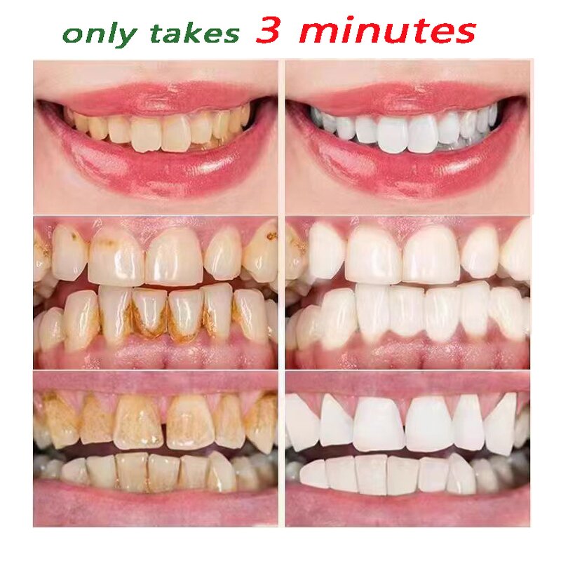 Bamboo Charcoal Toothpaste Supplier - OEM Deep Tooth Clean Dental Stains