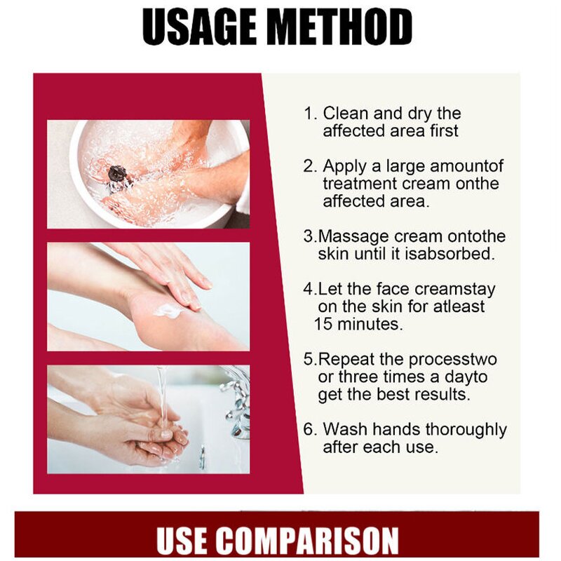 Counterpain Body Cream Supplier - OEM OEM Perfectx Joint Bone Valgus