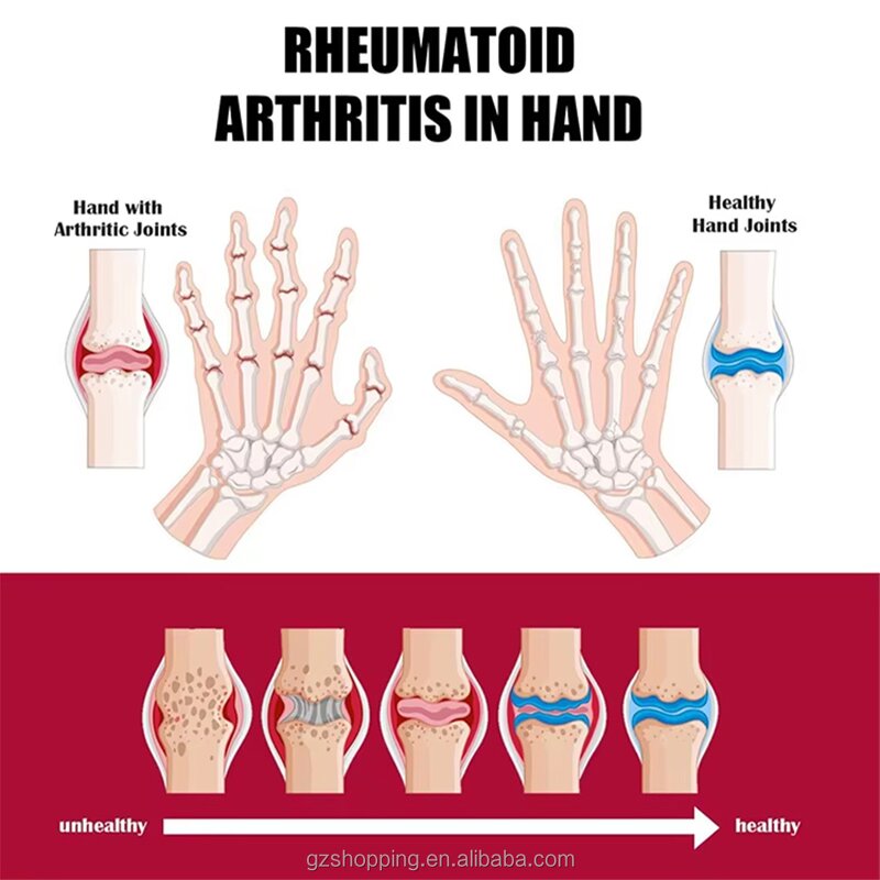 Joint Care Cream Manufacturer - OEM New Arrival Perfectx Cartilage Repair