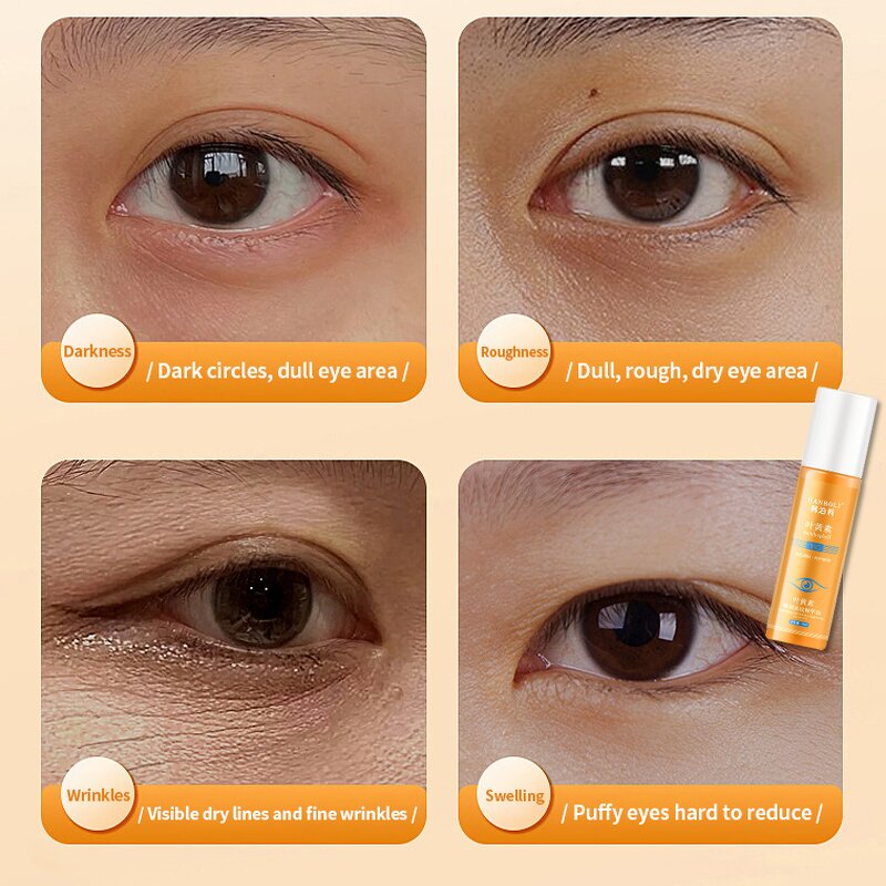 Eye Wrinkle Essence Manufacturer - OEM Wholesale Retinol VC Eye Essence