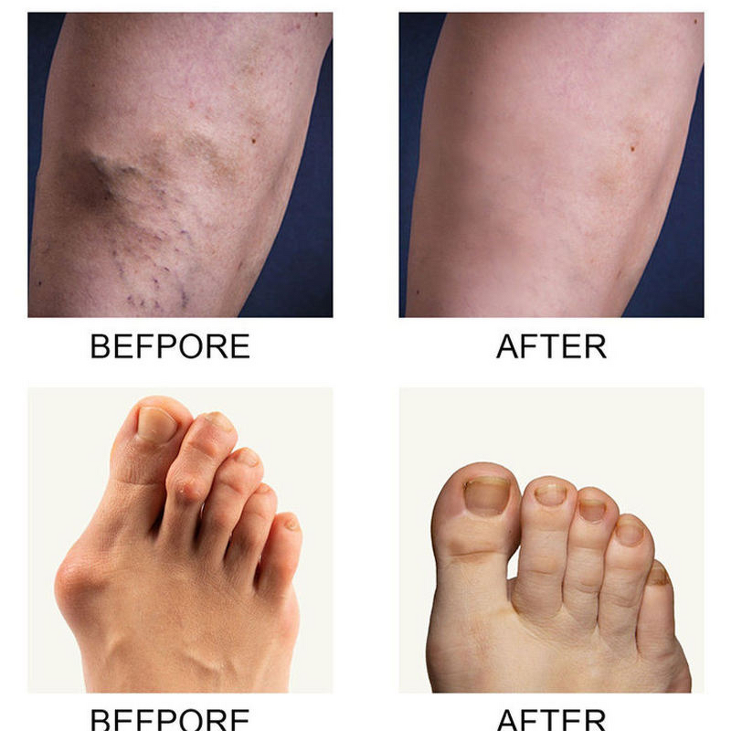 Therapy Body Cream Supplier - OEM High Quality Exclusive Brand OEM