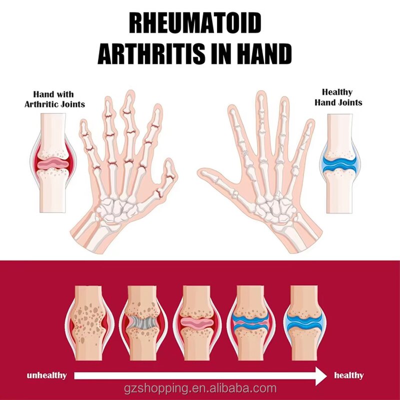 Joint Pain Cream Factory - OEM Bulk Supply Relieve Pain Inflammation