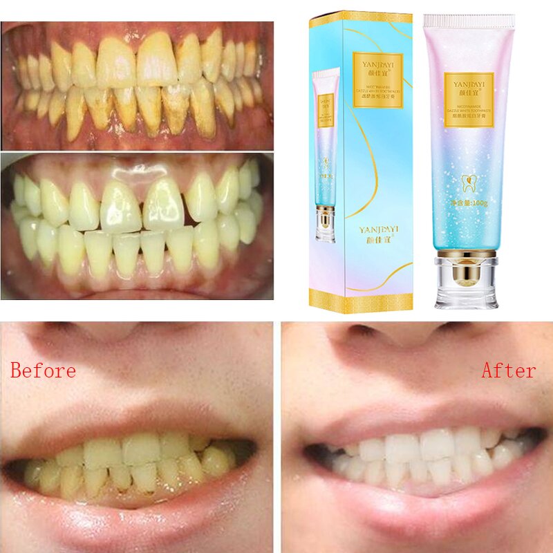 Niacinamide Toothpaste Factory - OEM Advanced Oral Care Herbal Mint