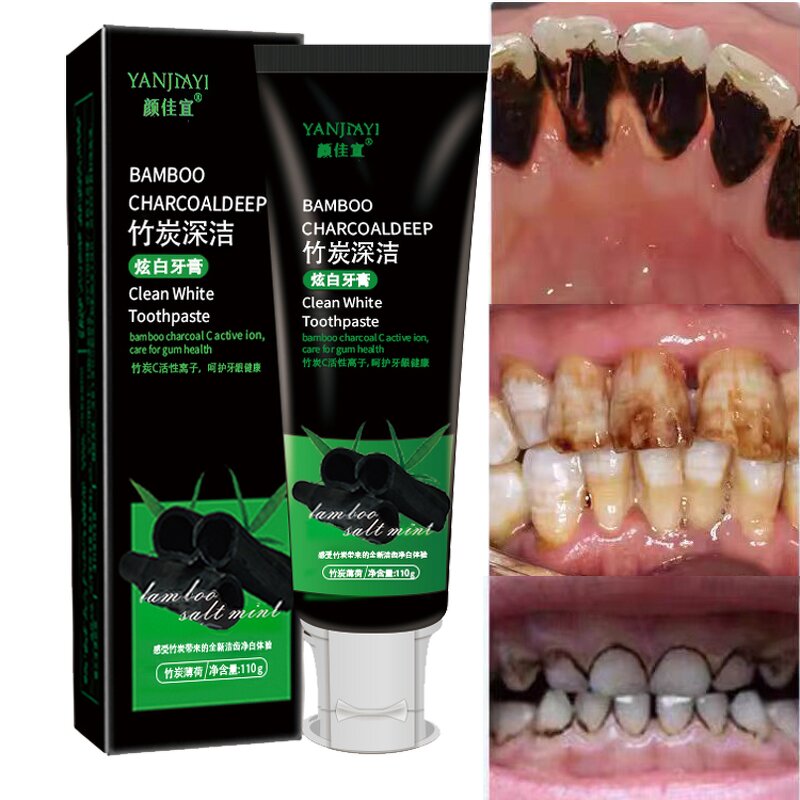 Bamboo Charcoal Toothpaste Supplier - OEM Deep Tooth Clean Dental Stains