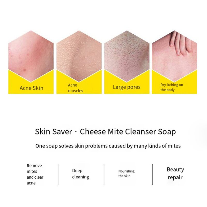 Cleansing Soap Supplier - OEM Cheese Brushed Mite Remove Soap