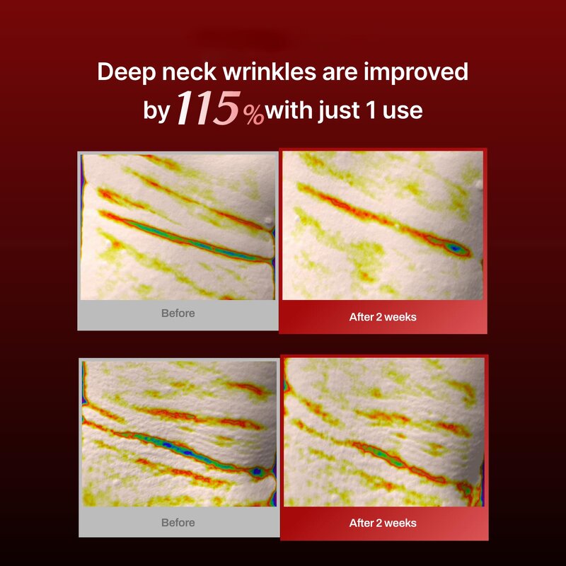Chin-Up Lifting Neck Mask Factory - OEM Collagen Face Neck Jelly Mask