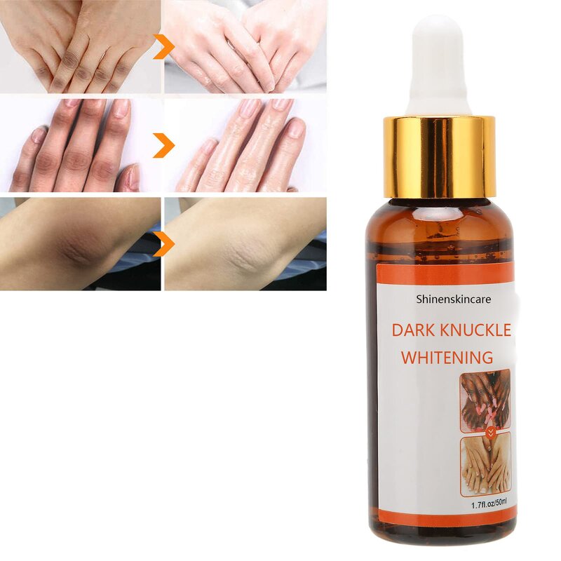 Hand Whitening Serum Supplier - OEM Private Label OEM ODM Hand