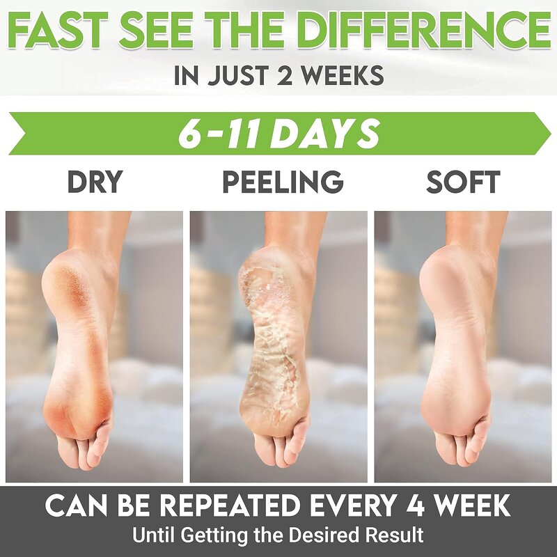 Foot Peeling Mask Manufacturer - OEM OEM Vegetable Oil Green Tea