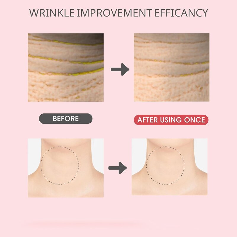 Niacinamide Eye Balm Factory - OEM Natural Skincare Remove Eye Bags