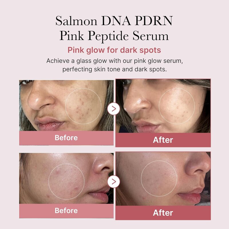 Salmon PDRN Serum Supplier - OEM Korean Cosmetic OEM ODM Wrinkles