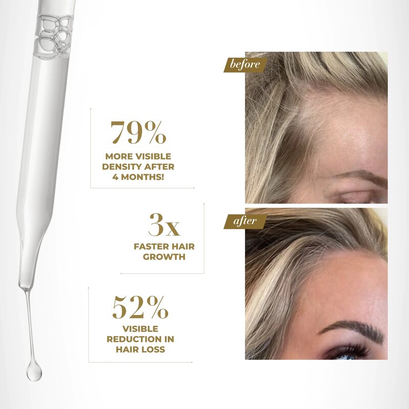 Caffeine Peptide Scalp Serum Manufacturer - OEM For Women Men Hair Regrowth