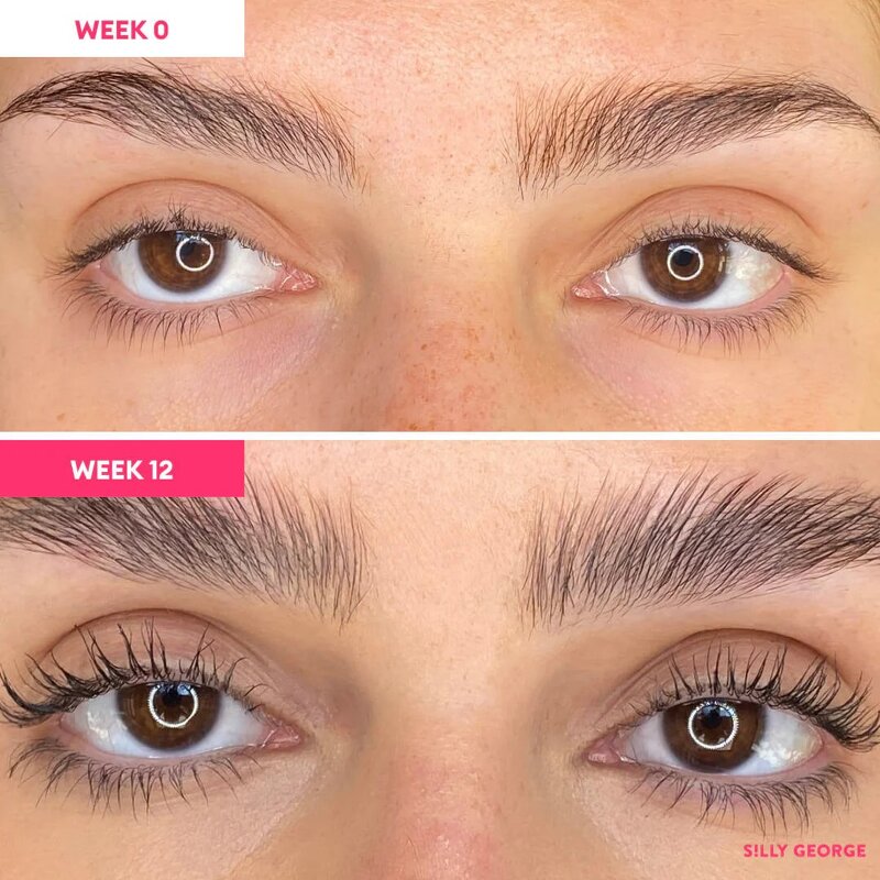 Eyelash Growth Serum Supplier - OEM Best Selling Vegan 5ml Day Night