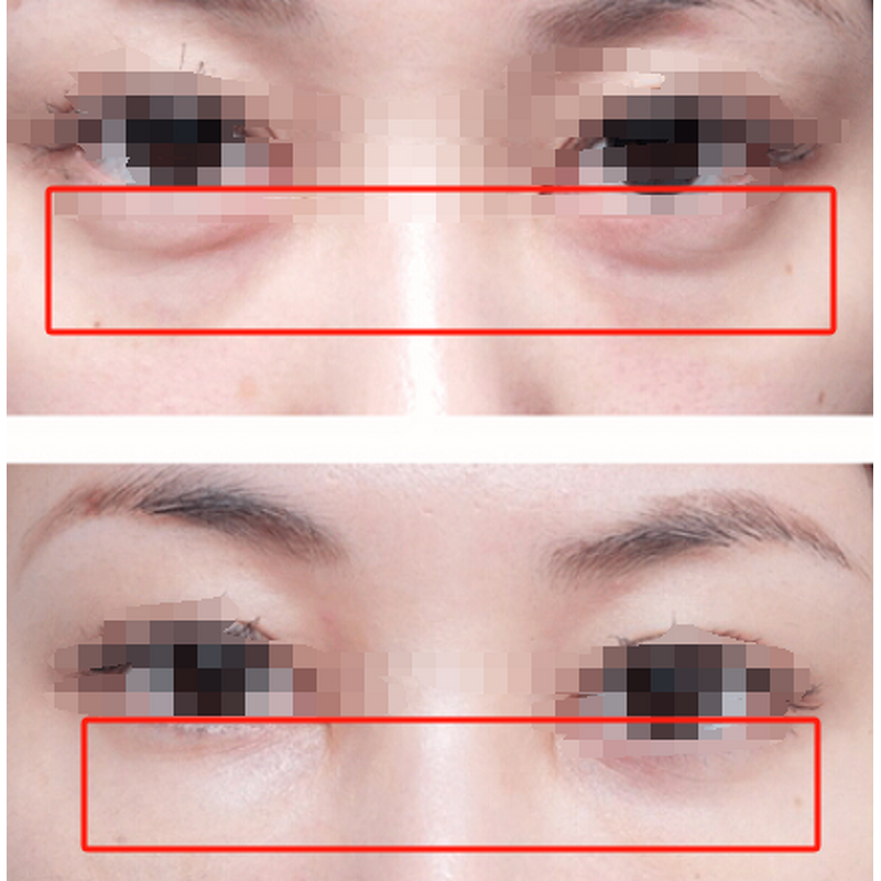 PDRN Firming Eye Cream Manufacturer - OEM Korean Cosmetic Remove Fine