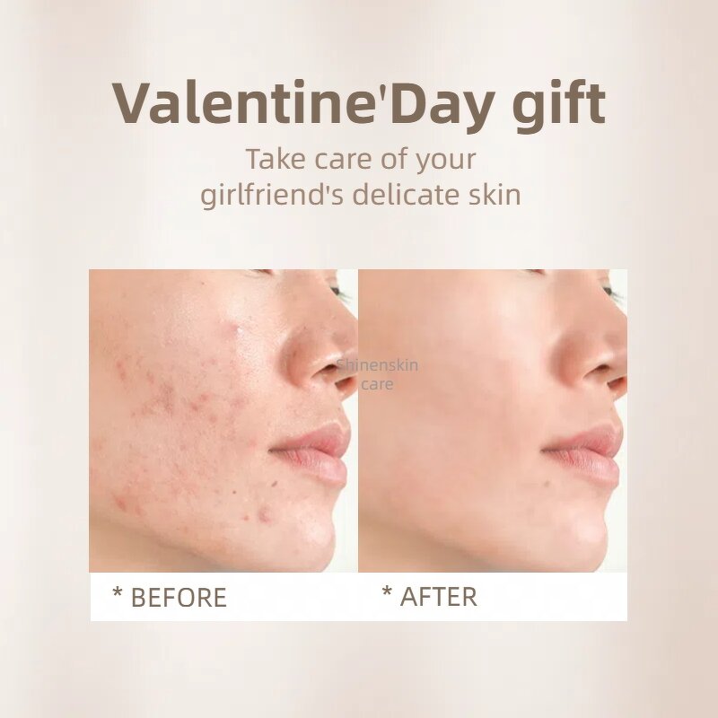 Facial Kit Factory - OEM Korea Cosmetic for Men Anti Acne